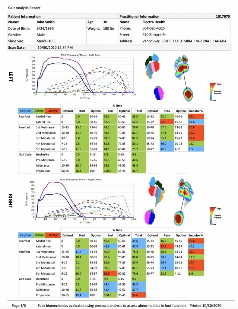 vancouver foot orthotics scan and analysis